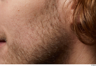 HD Arvid cheek face hair skin pores skin texture 0002.jpg